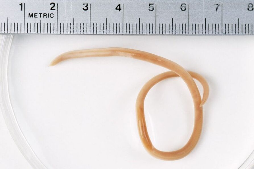 Ascaris is a roundworm living in the human body